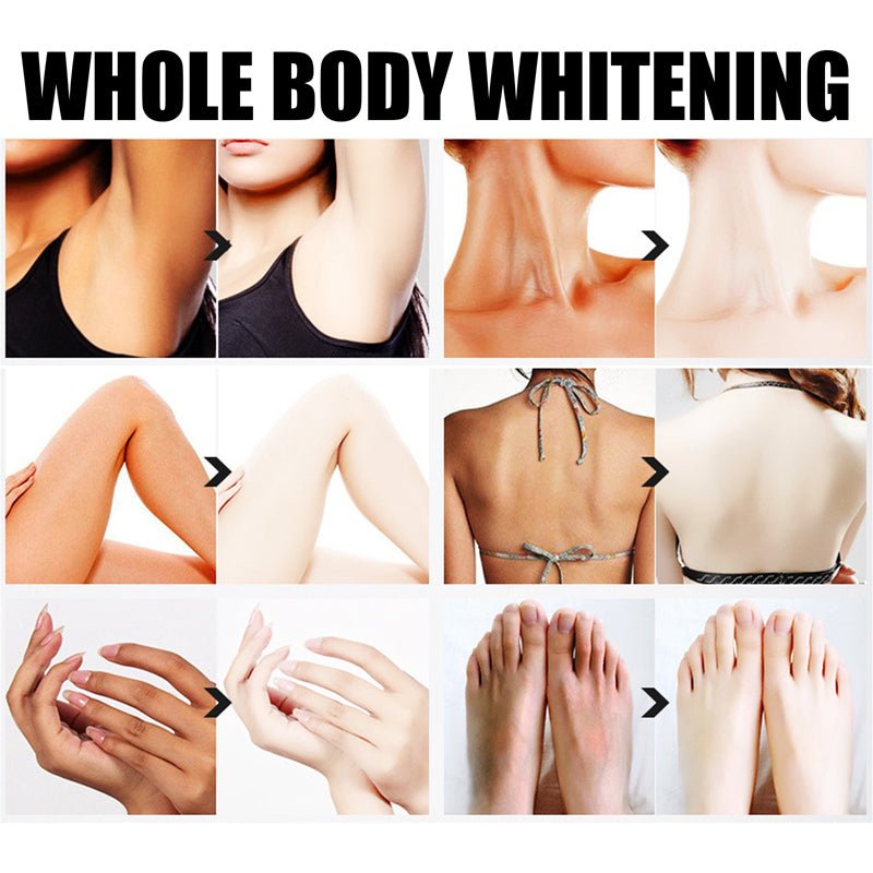 Body Whitening Cream Underarm Armpit Knee Dark Skin Whitening Moisturizing Brighten Body Lotion - Starttech Online Market