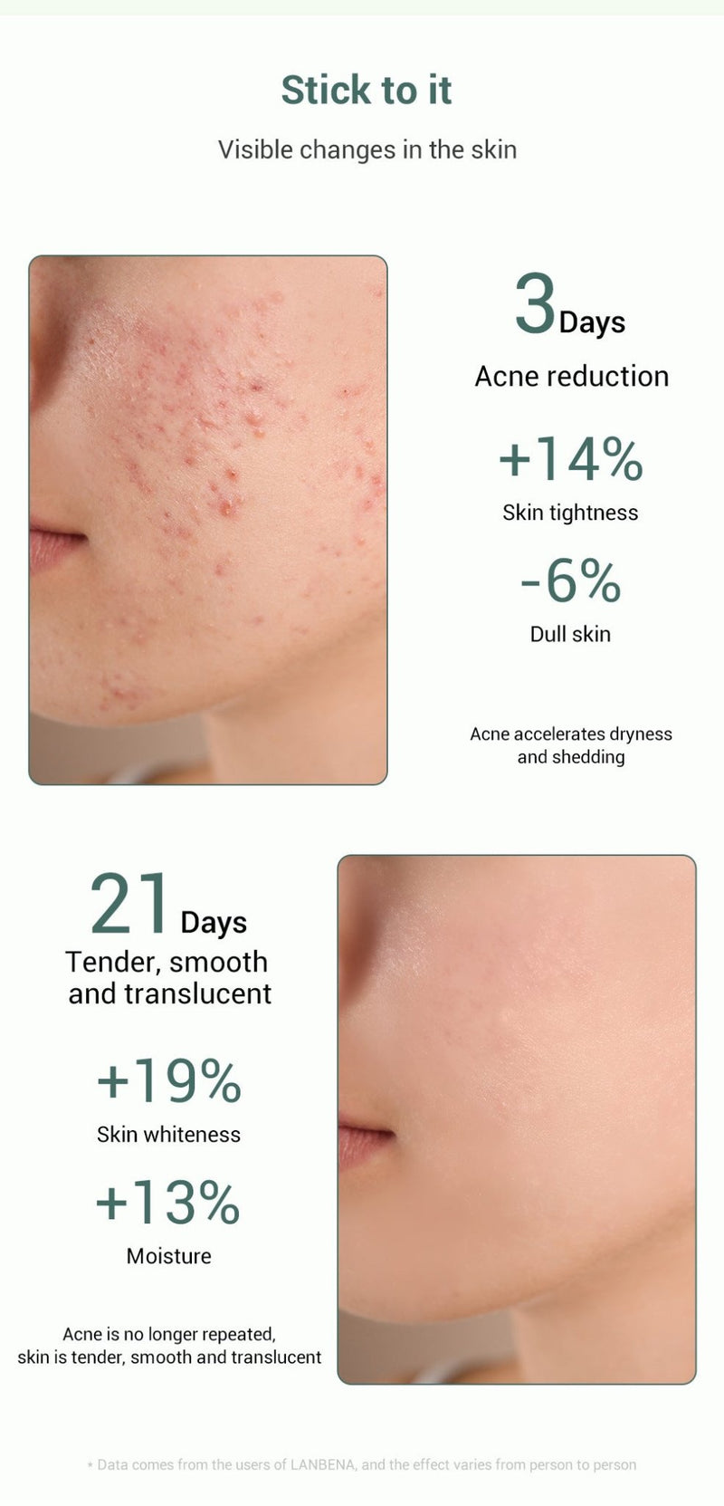 LANBENA Acne Removal Serum Salicylic Acid Anti-Acne Repair Fade Acne Spots Pimple Oil Control Cream Whitening Moisturizing Care - Starttech Online Market